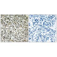 Rabbit Polyclonal Antibody to CEP152