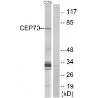 Rabbit Polyclonal Antibody to CEP7