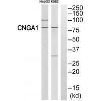 Rabbit Polyclonal Antibody to CNGA1