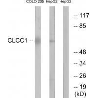Rabbit Polyclonal Antibody to CLCC1