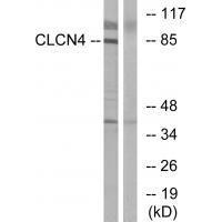 Rabbit Polyclonal Antibody to CLCN4