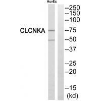 Rabbit Polyclonal Antibody to CLCNKA