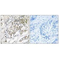 Rabbit Polyclonal Antibody to CDYLy2 Antibod