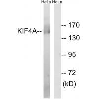 Rabbit Polyclonal Antibody to KIF4A
