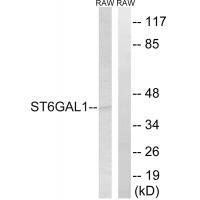 Rabbit Polyclonal Antibody to ST6GAL1