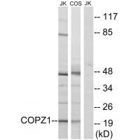 Rabbit Polyclonal Antibody to COPZ1