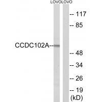 Rabbit Polyclonal Antibody to CCDC102A