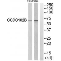 Rabbit Polyclonal Antibody to CCDC102B