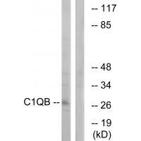 Rabbit Polyclonal Antibody to C1QB
