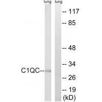 Rabbit Polyclonal Antibody to C1QC
