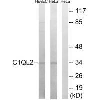 Rabbit Polyclonal Antibody to C1QL2