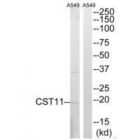 Rabbit Polyclonal Antibody to CST11