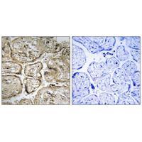 Rabbit Polyclonal Antibody to CST9L