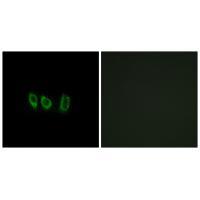 Rabbit Polyclonal Antibody to CSTL1