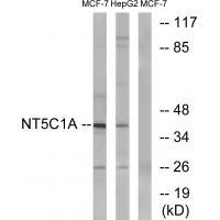 Rabbit Polyclonal Antibody to NT5C1A