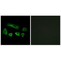 Rabbit Polyclonal Antibody to NT5C1B