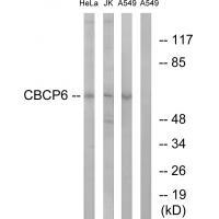 Rabbit Polyclonal Antibody to CBCP6