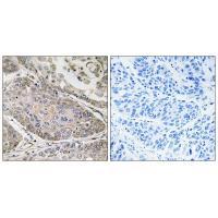 Rabbit Polyclonal Antibody to PLA2G4E