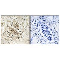 Rabbit Polyclonal Antibody to Myc