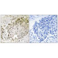 Rabbit Polyclonal Antibody to RFX2