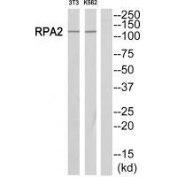 Rabbit Polyclonal Antibody to POLR1B