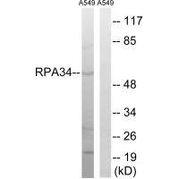 Rabbit Polyclonal Antibody to CD3EAP