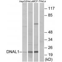 Rabbit Polyclonal Antibody to DNAL1