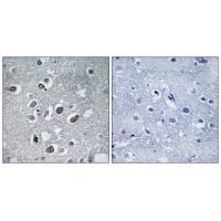 Rabbit Polyclonal Antibody to 44989