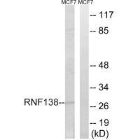 Rabbit Polyclonal Antibody to RNF138