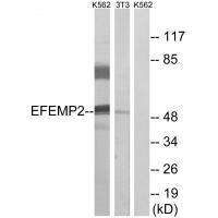 Rabbit Polyclonal Antibody to EFEMP2