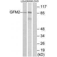 Rabbit Polyclonal Antibody to GFM2