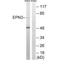 Rabbit Polyclonal Antibody to EPN3