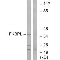 Rabbit Polyclonal Antibody to FKBPL