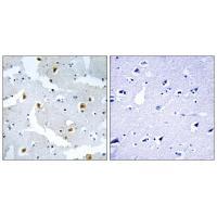 Rabbit Polyclonal Antibody to FMN2
