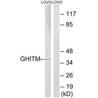 Rabbit Polyclonal Antibody to GHITM