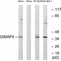 Rabbit Polyclonal Antibody to GIMAP4