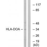Rabbit Polyclonal Antibody to HLA-DOA