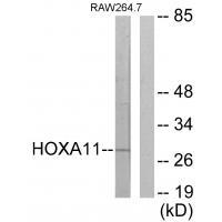 Rabbit Polyclonal Antibody to HOXA11/D11