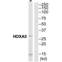 Rabbit Polyclonal Antibody to HXA5