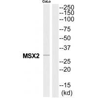 Rabbit Polyclonal Antibody to MSX2