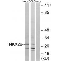 Rabbit Polyclonal Antibody to NKX26