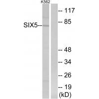 Rabbit Polyclonal Antibody to SIX5
