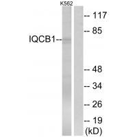 Rabbit Polyclonal Antibody to IQCB1