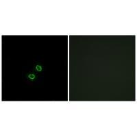 Rabbit Polyclonal Antibody to KIR2DL5B