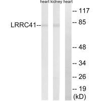 Rabbit Polyclonal Antibody to LRRC41