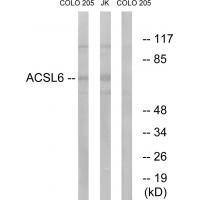 Rabbit Polyclonal Antibody to ACSL6