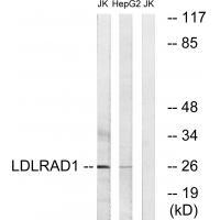 Rabbit Polyclonal Antibody to LDLRAD1