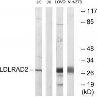 Rabbit Polyclonal Antibody to LDLRAD2