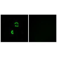 Rabbit Polyclonal Antibody to LDLRAD3