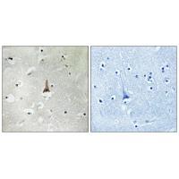 Rabbit Polyclonal Antibody to LRP1